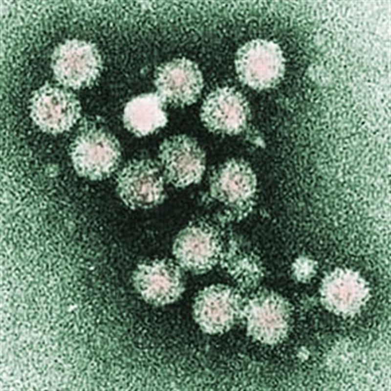 Virus de la viruela en los canarios y agapornis
